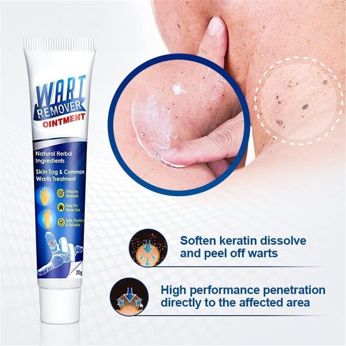 Rejuvice™️ Wart Remover