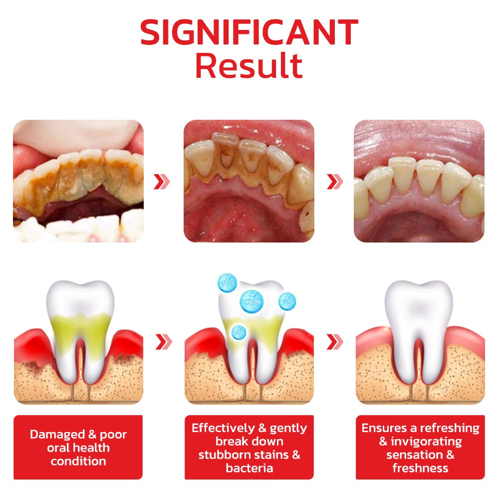 SP-4 Probiotic Toothpaste